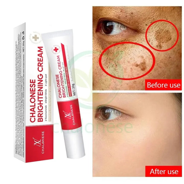 CHALONESE BRIGHTENING CREAM